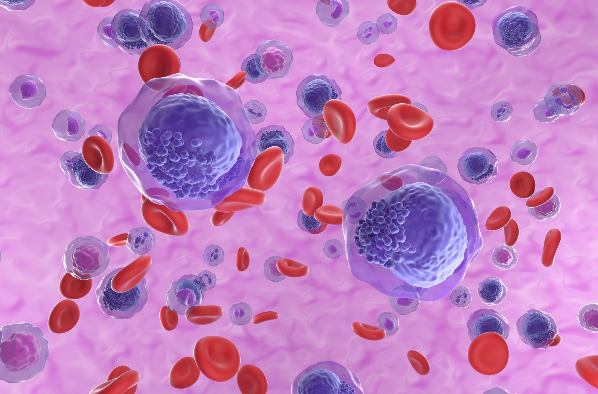 Study: Inflammatory bone marrow signaling in pediatric acute myeloid leukemia distinguishes patients with poor outcomes. Image Credit: Nemes Laszlo/Shutterstock
