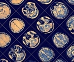 Study implicates gut microbiome health in Parkinson's disease