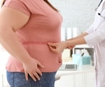 What advice is being given by general practitioners to people living with obesity?