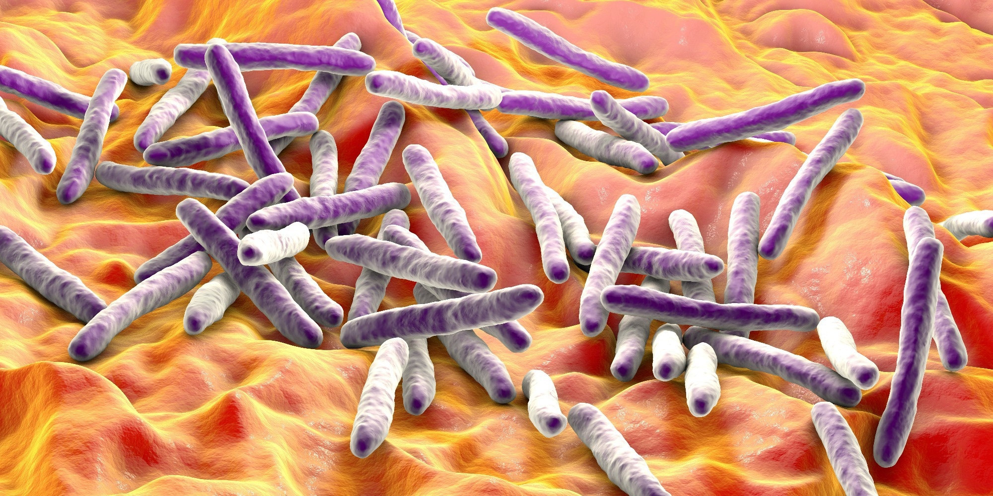 Study: Mycobacterium tuberculosis hijacks ubiquitin to inhibit pyroptosis. Image Credit: Kateryna Kon/Shutterstock