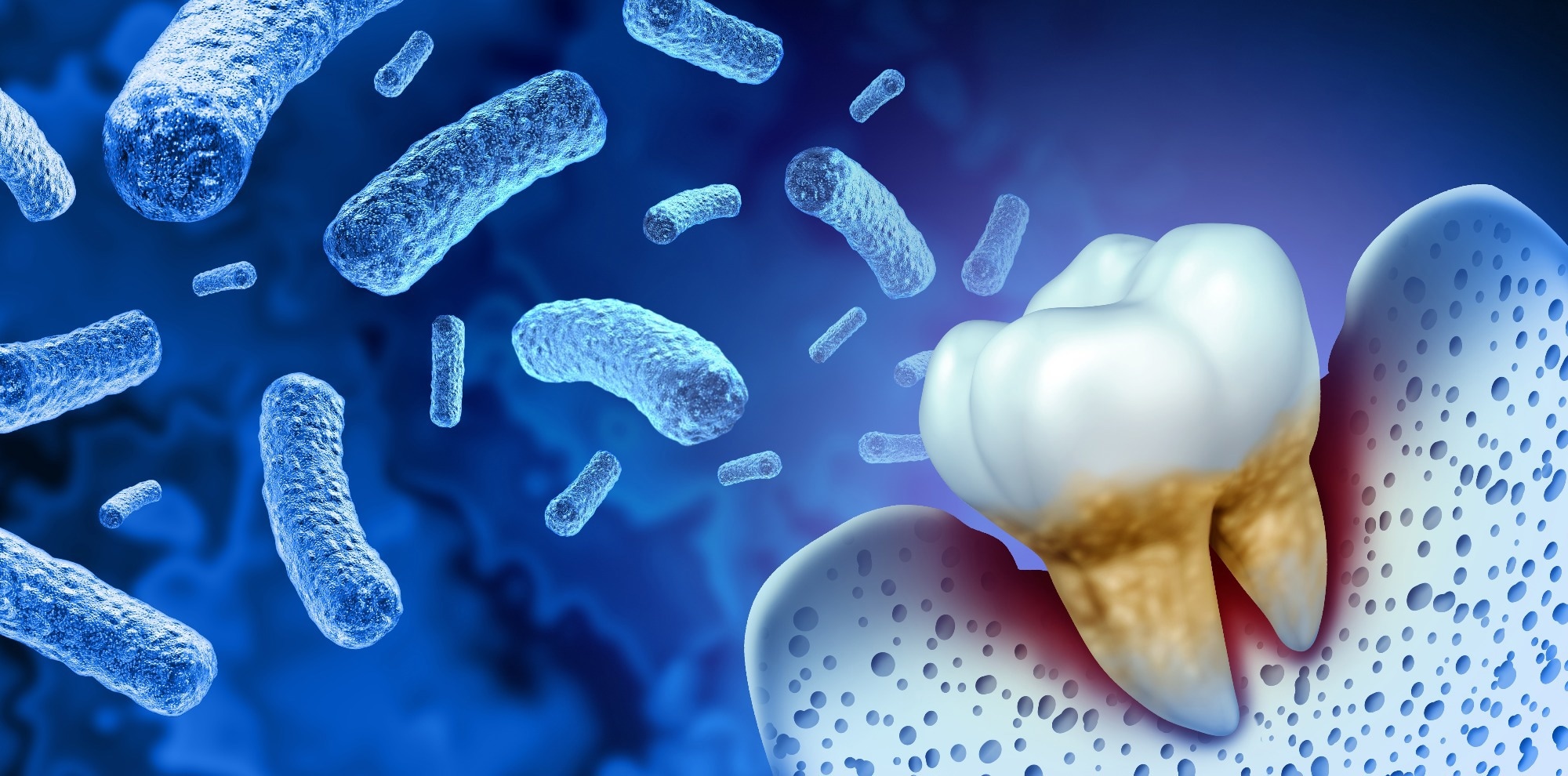 How could probiotics be used in the management of gingivitis and periodontitis?