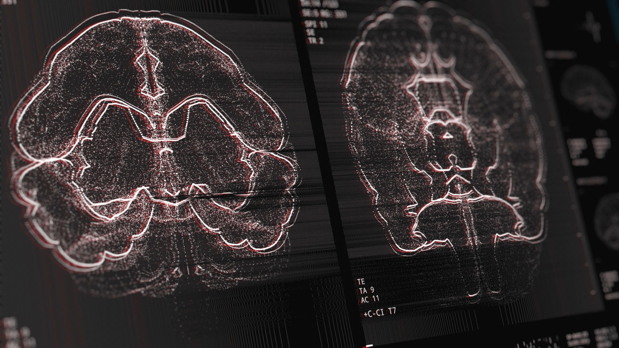 Can artificial intelligence pass the Fellowship of the Royal College of Radiologists examination? Multi-reader diagnostic accuracy study. Image Credit: SquareMotion / Shutterstock