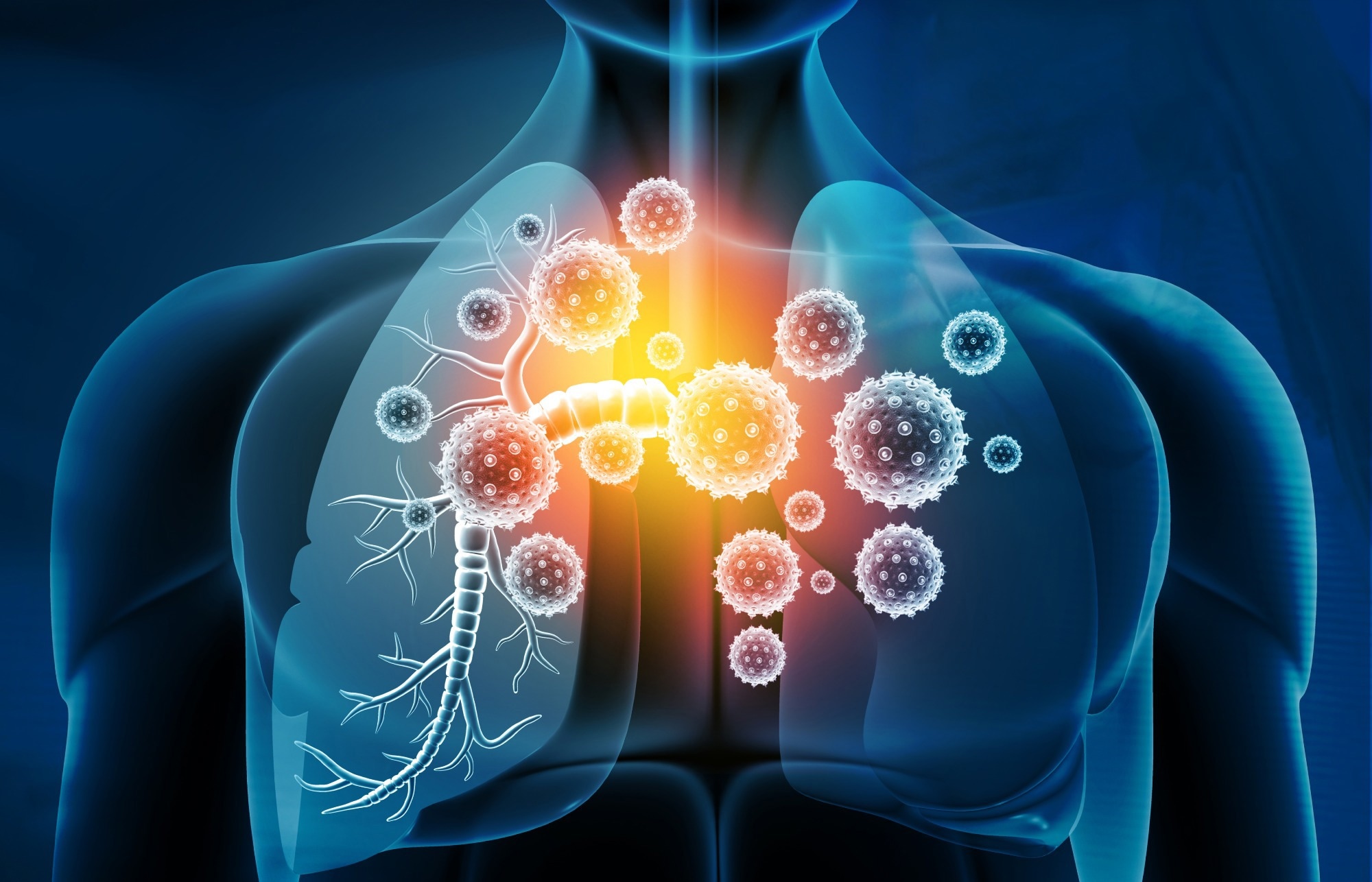 Study: COVID-Specific Long-Term Sequelae in Comparison to Common Viral Respiratory Infections: An Analysis of 17,487 Infected Adult Patients. Image Credit: Explode/Shutterstock