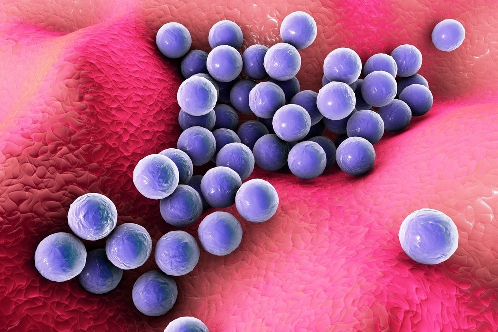 Étude : La protéine IsdA de Staphylococcus aureus augmente la réplication du SRAS CoV-2 en modulant la signalisation JAK-STAT.  Crédit d'image : Kateryna Kon/Shutterstock