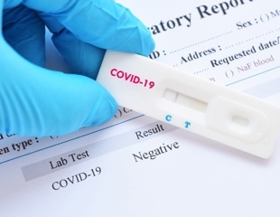 Analysis of seemingly recovered COVID-19 patients indicates that SARS-CoV-2 infection can persist significantly longer than suggested by PCR-negative tests