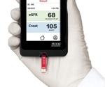Nova Biomedical Launches CE-Marked Nova Max Pro Creatinine/eGFR Meter for Kidney Function Screening