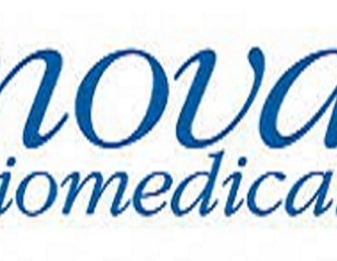 Nova Biomedical Launches BioProfile® FAST CDV for High Throughput, Fully Automated  Cell Density and Cell Viability Analysis