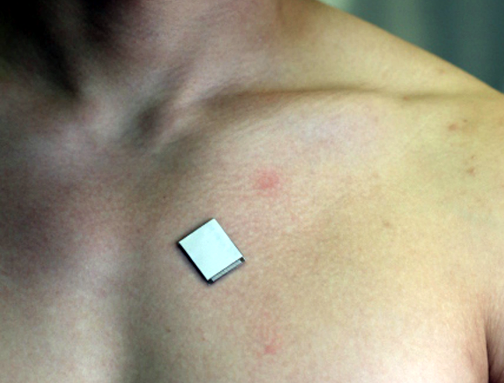 The wearable ultrasound sensor is roughly the size of a postage stamp, can be worn for up to 24 hours, and works even during strenuous exercise. Image Credit: Xu Laboratory, UC San Diego Jacobs School of Engineering