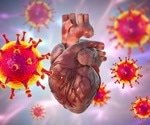 COVID pandemic caused cardiovascular deaths to rise sharply