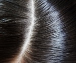 Can hair cortisol serve as a biomarker for mood in bipolar disorder?