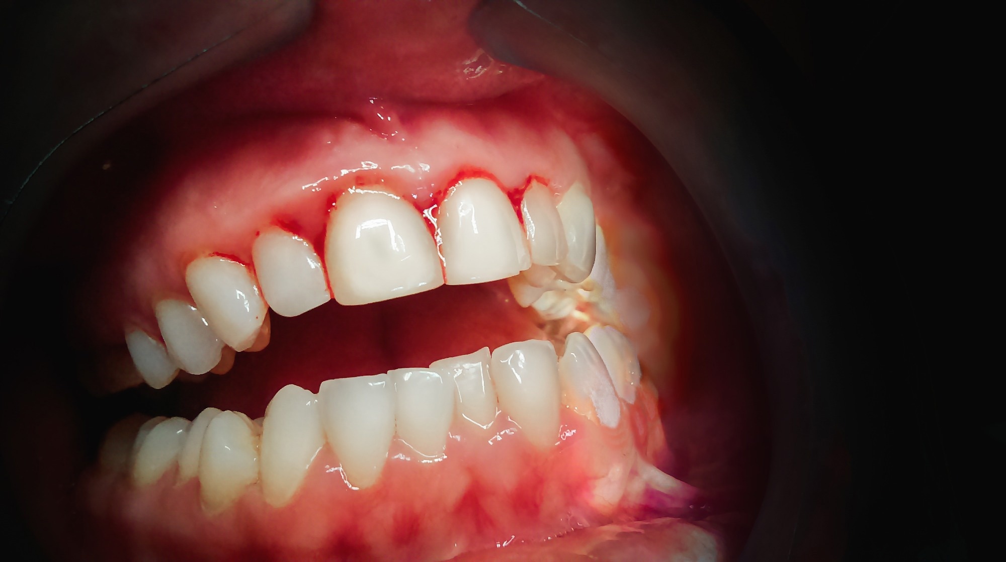 Study: Periodontitis and COVID-19: Immunological Characteristics, Related Pathways, and Association. Image Credit: Algirdas Gelazius / Shutterstock