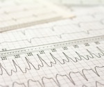 Researchers report two unusual COVID-19-related arrhythmic cases in children