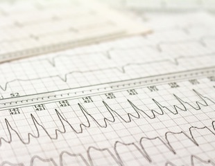 Researchers report two unusual COVID-19-related arrhythmic cases in children
