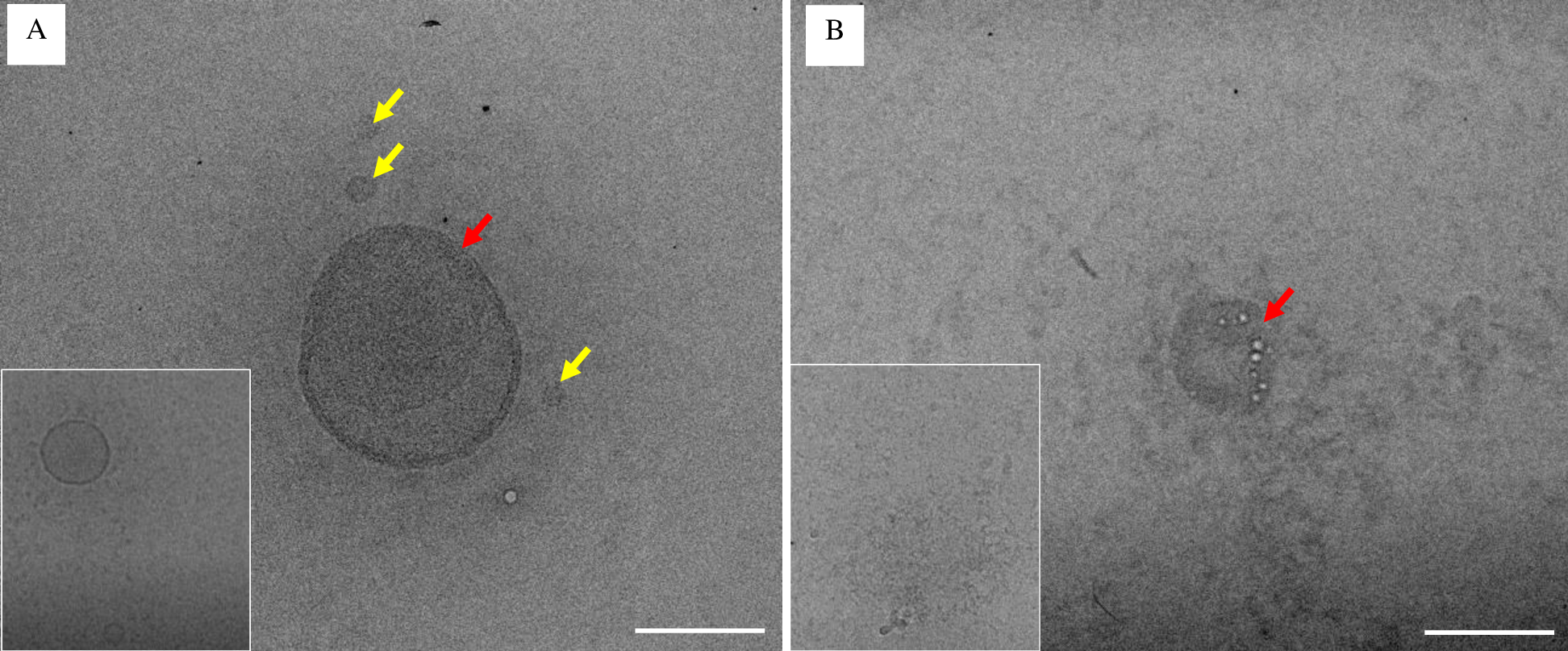 Effect of vinegar on SARS-CoV-2 viral particles by transmission electron microscope (TEM). (A-B) Representative TEM images. (A) The untreated cells, water (- vinegar) SARS-CoV-2 viral particles shows morphodiagnostic features of family Coronaviridae with morphologically intact structure whereas (B) Cells treated with 6% acetic acid (+ vinegar) SARS-CoV-2 viral particles showing presence of abnormal viral morphodiagnostic with misshapen structure with fewer viral particles, and disorganized virion structure. Scale bar = A-B 100nm. Insets are shown from additional images of the same sample.