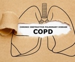 Utilizing CRISPR to discover new therapy options for COPD