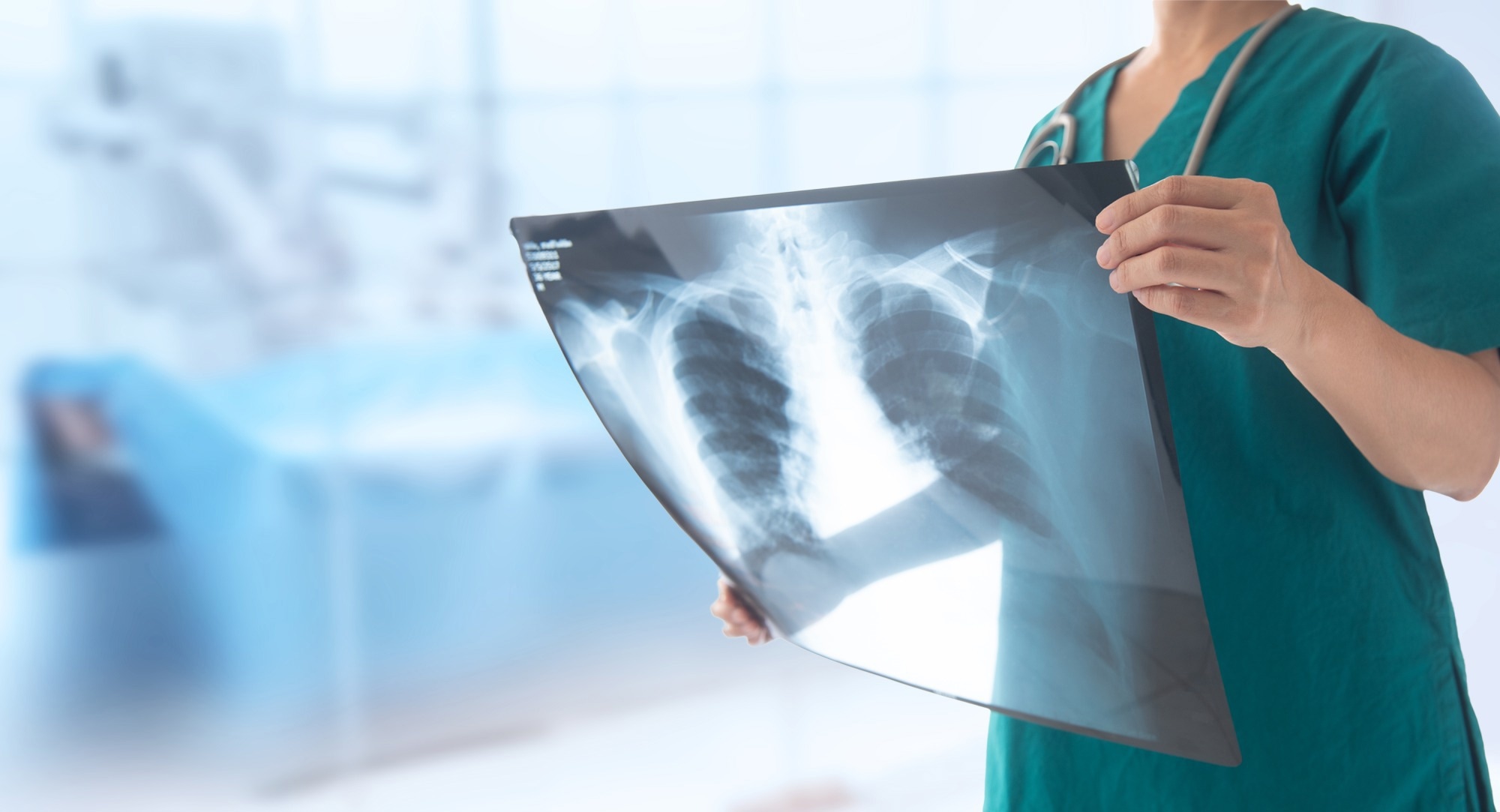 Study: Longitudinal Assessment of Chest CT Findings and Pulmonary Function in Patients after COVID-19. Image Credit: create jobs 51 / Shutterstock