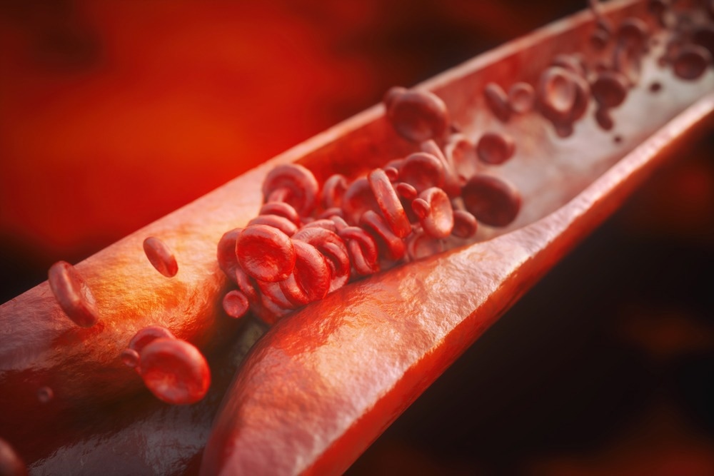 Study: Pairing of single-cell RNA analysis and T cell antigen receptor profiling indicates breakdown of T cell tolerance checkpoints in atherosclerosis. Image Credit: Crevis/Shutterstock