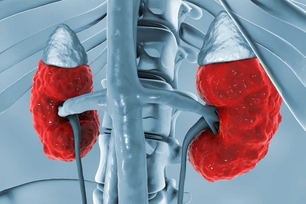 Study: A qualitative study exploring self-management behaviour of patients with chronic kidney disease during COVID-19. Image Credit: Kateryna Kon/Shutterstock