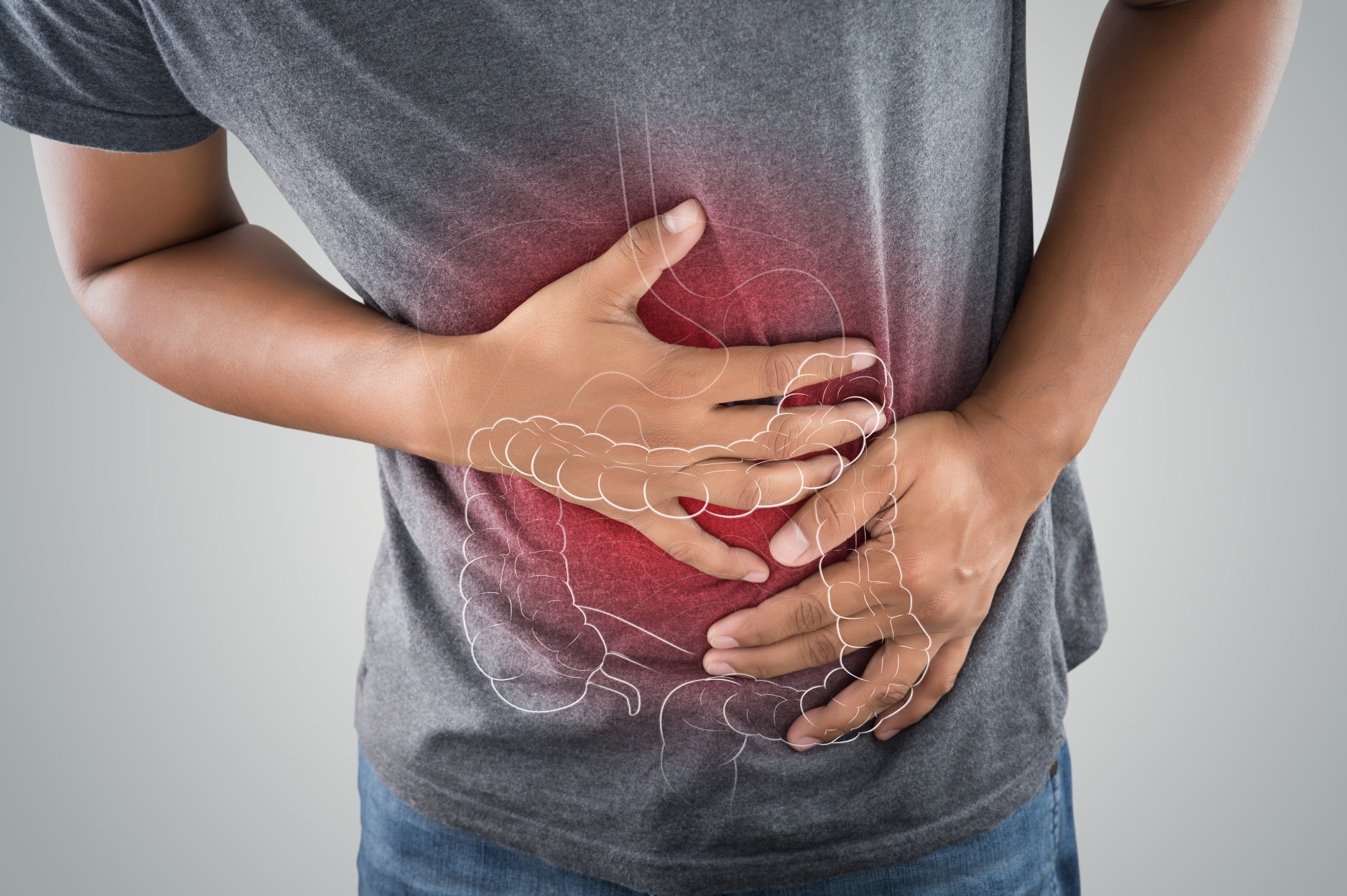 Study: Artificial Intelligence enabled histological prediction of remission or activity and clinical outcomes in ulcerative colitis. Image Credit: Emily frost/Shutterstock