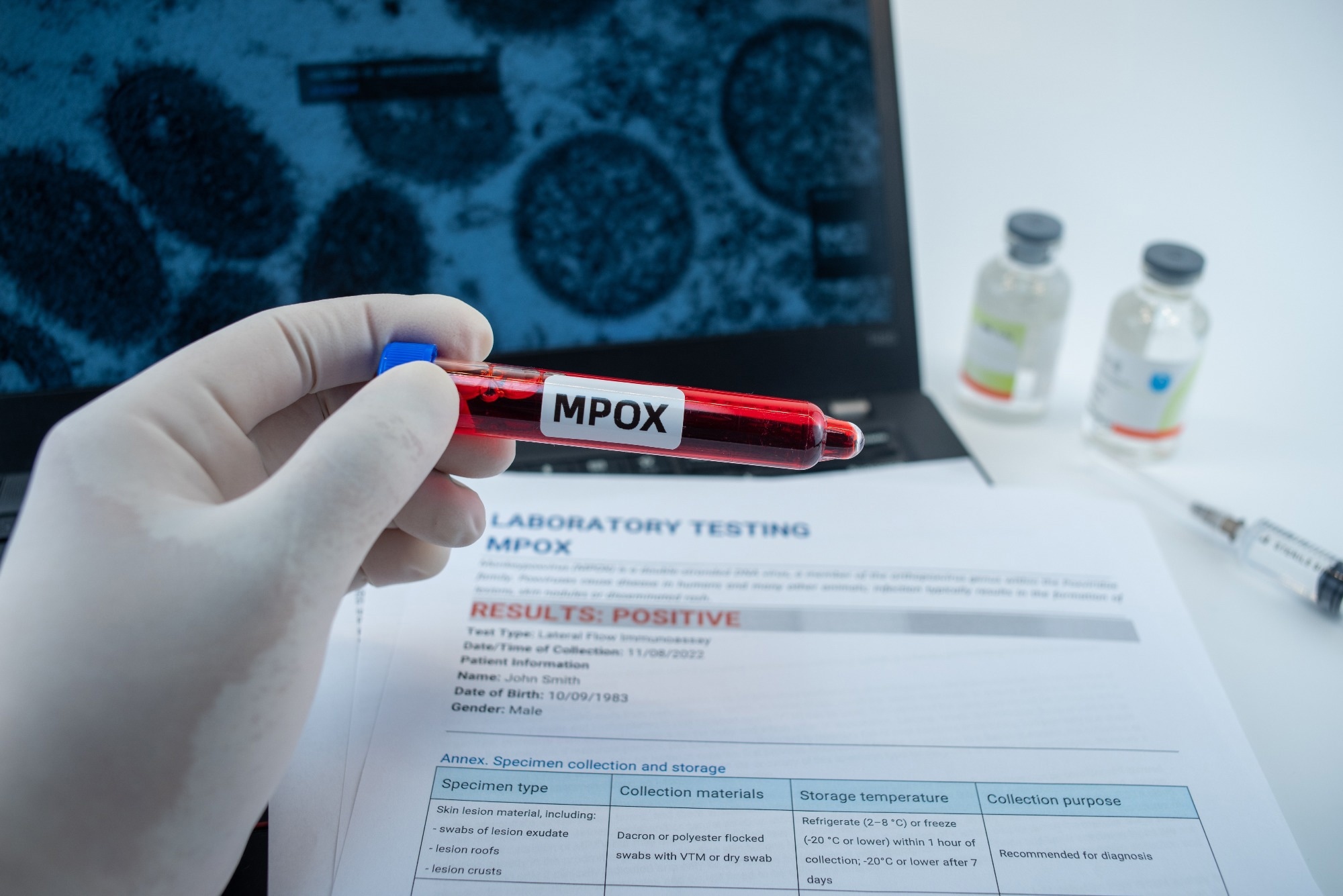 Study: Mpox respiratory transmission: the state of the evidence. Image Credit: QINQIE99/Shutterstock