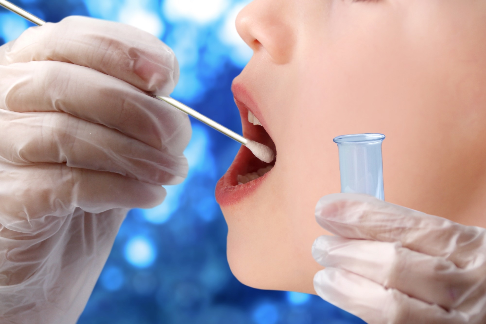 Study: Oral SARS-CoV-2 host responses predict the early COVID-19 disease course. Image Credit: Kittyfly / Shutterstock