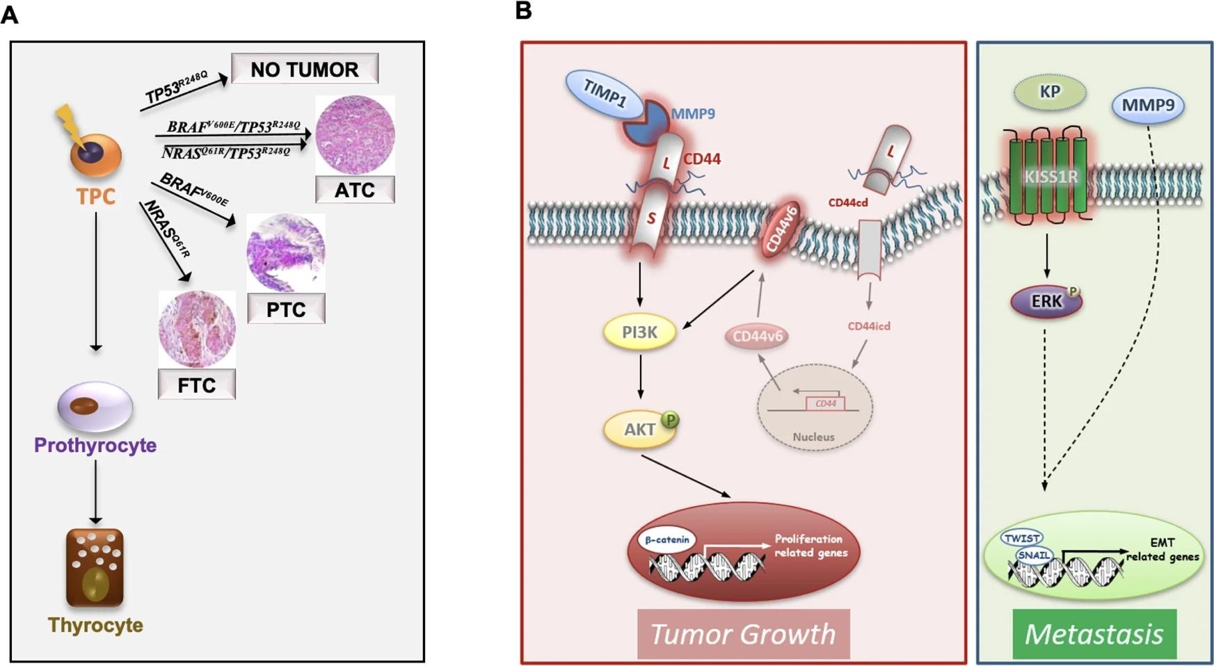 Схематическая модель, показывающая, что наиболее распространенные генетические изменения TC (BRAFV600E, NRASQ61R, BRAFV600E/TP53R248Q и NRASQ61R/TP53R248Q) в клетках-предшественниках щитовидной железы (TPC) повторяют различные гистотипы TC (FTC, PTC и ATC).  Следует отметить, что TP53R248Q сам по себе не требуется для инициации TC.  B Модель тройных комплексов (TIMP1/MMP9/CD44) и путей, управляемых KISS1R, в модифицированных TPC D22.  Образование комплексов TIMP1 и про-MMP9 активирует MMP9 и, следовательно, приводит к расщеплению CD44.  Внутрицитоплазматический домен CD44 (CD44icd) перемещается в ядро, где индуцирует транскрипцию CD44v6.  CD44v6 способствует пролиферации TPC через путь PI3K/AKT.  Связывание кисспептинов (KPs) с KISS1R активирует ERK и взаимодействует с MMP9, чтобы способствовать транскрипции генов, связанных с EMT, включая TWIST и SNAIL, что приводит к метастатическому приживлению трансплантата.