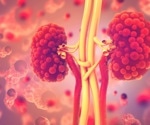 An emerging target for chronic kidney disease treatment - DNA-PKcs