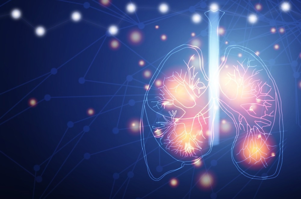 Study: Intelligent Genetic Decoding System Based on Nucleic Acid Isothermal Amplification for Non-Small Cell Lung Cancer Diagnosis. Image Credit: Anucha Tiemsom/Shutterstock