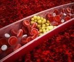 New study investigates effect of short-term PM2.5 exposure on blood lipids