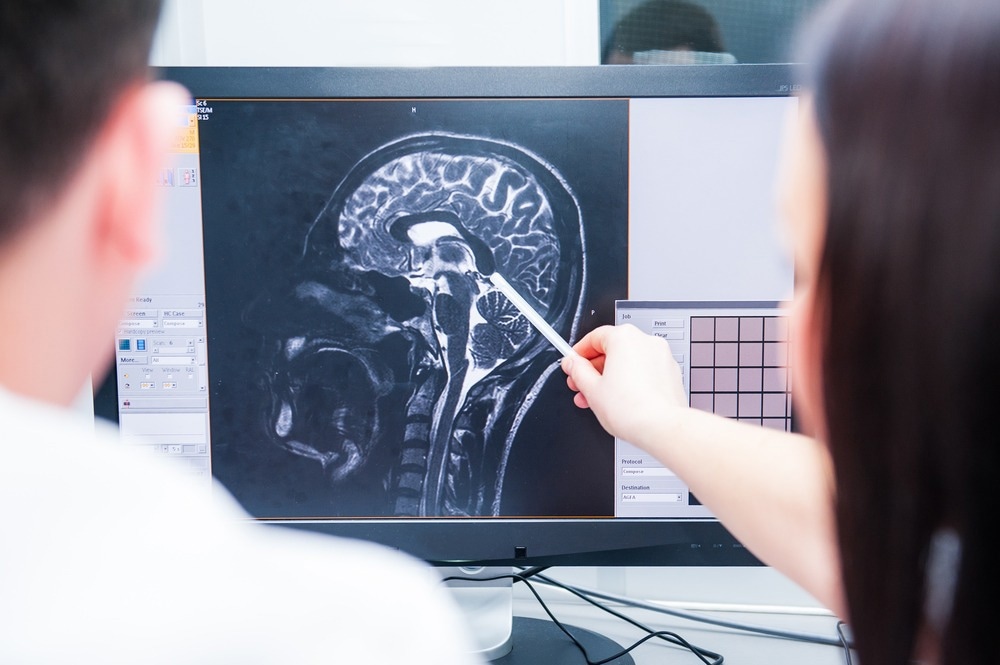 Study: Functional Recovery, Symptoms, and Quality of Life 1 to 5 Years After Traumatic Brain Injury. Image Credit: Okrasiuk/Shutterstock.com