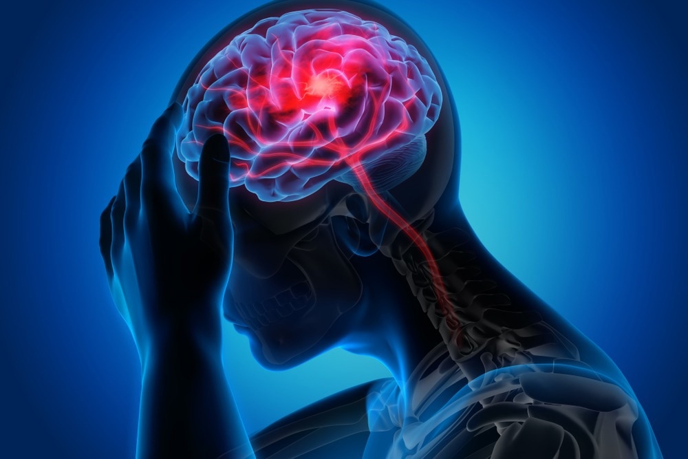Study: Genetic analyses identify brain structures related to cognitive impairment associated with elevated blood pressure. Image Credit: peterschreiber.media/Shutterstock