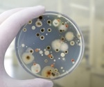 Plastic waste's 'plastisphere' could harbor and spread eukaryotic pathogens