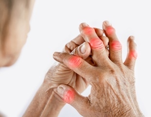 Study investigates vitamin C's effectiveness in treating gout and hyperuricemia