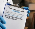 Revolution in MDR-TB treatment: Shorter all-oral regimens