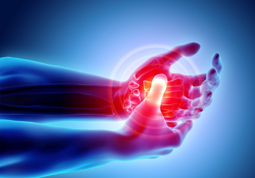 Study: The role of the microbiome in rheumatoid arthritis: a review. Image Credit: MDGRPHCS/Shutterstock,com