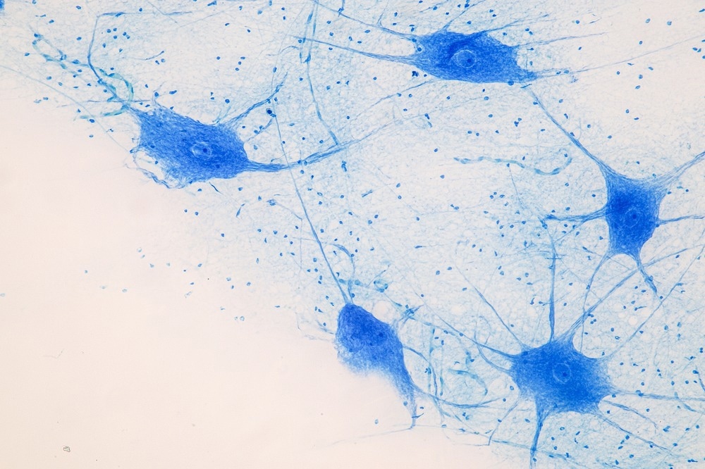 Study: OPA pheomelanin is increased in nigral neuromelanin of Parkinson’s disease. Image Credit: Rattiya Thongdumhyu / Shutterstock.com