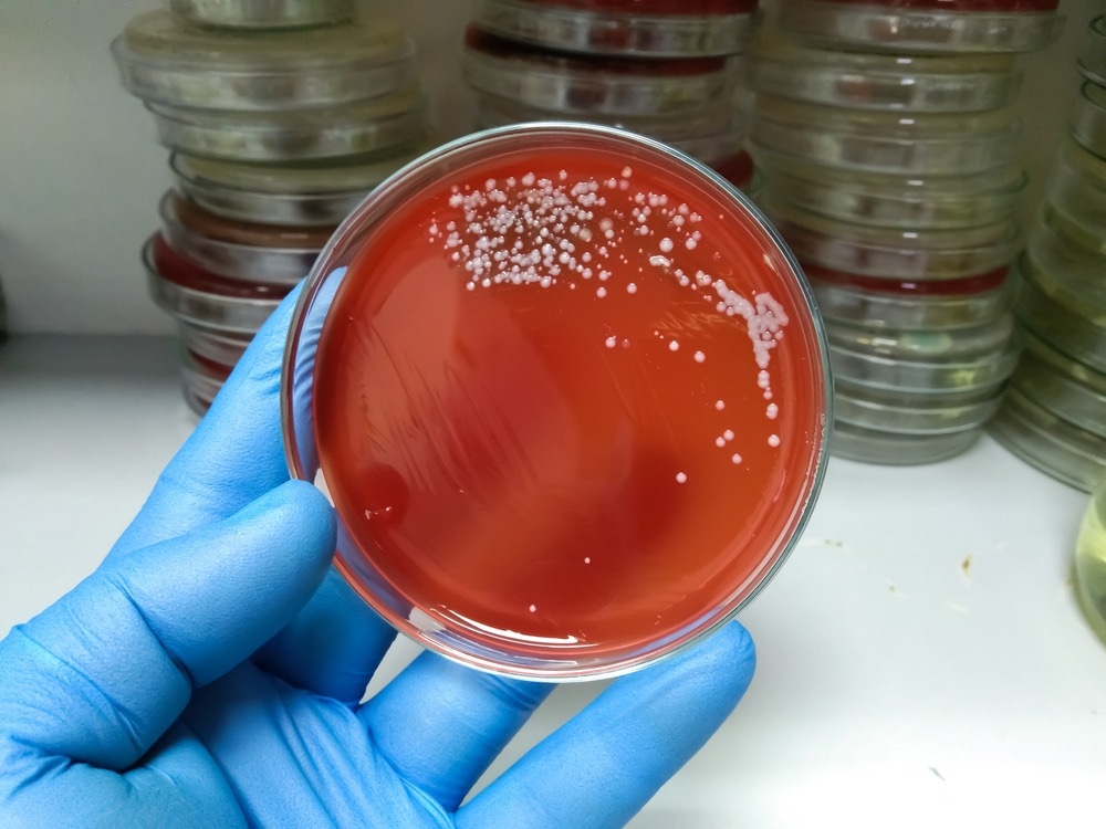 Study: Emerging Invasive Group A Streptococcus M1UK Lineage Detected by Allele-Specific PCR, England, 2020. Image Credit: Arifbiswas/Shutterstock.com