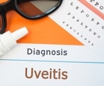 Study explores the association between gut microbiome dysbiosis and uveitis