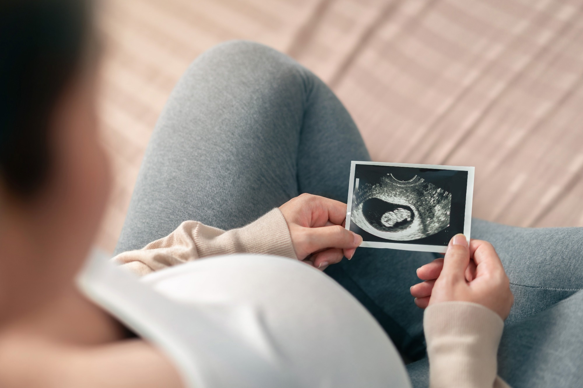 Study: Prenatal environmental exposures associated with sex differences in childhood obesity and neurodevelopment. Image Credit: Chanintorn.v / Shutterstock