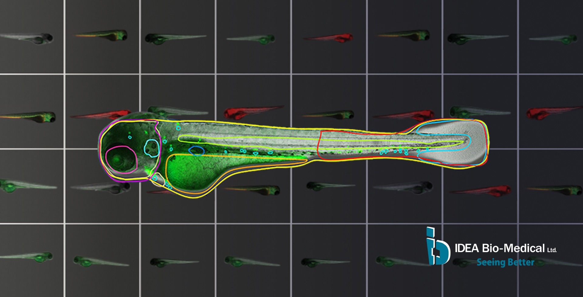 Why do we need information about Zebrafish anatomy to interpret fluorescence signals?