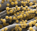 Study reveals alarming global burden of antimicrobial resistance in bacterial infections