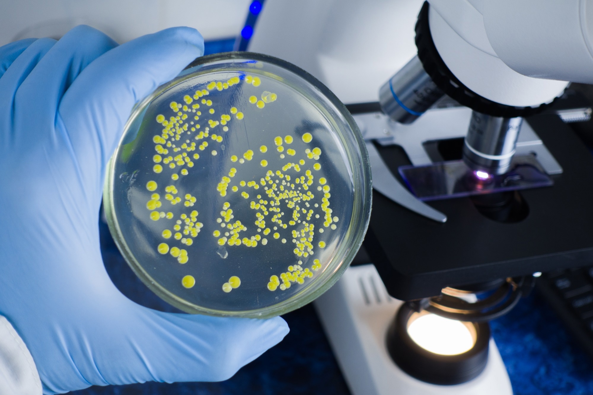 Study: Fecal microbiota transplantation for the treatment of recurrent Clostridioides difficile (Clostridium difficile). Image Credit: Prrrettty / Shutterstock.com