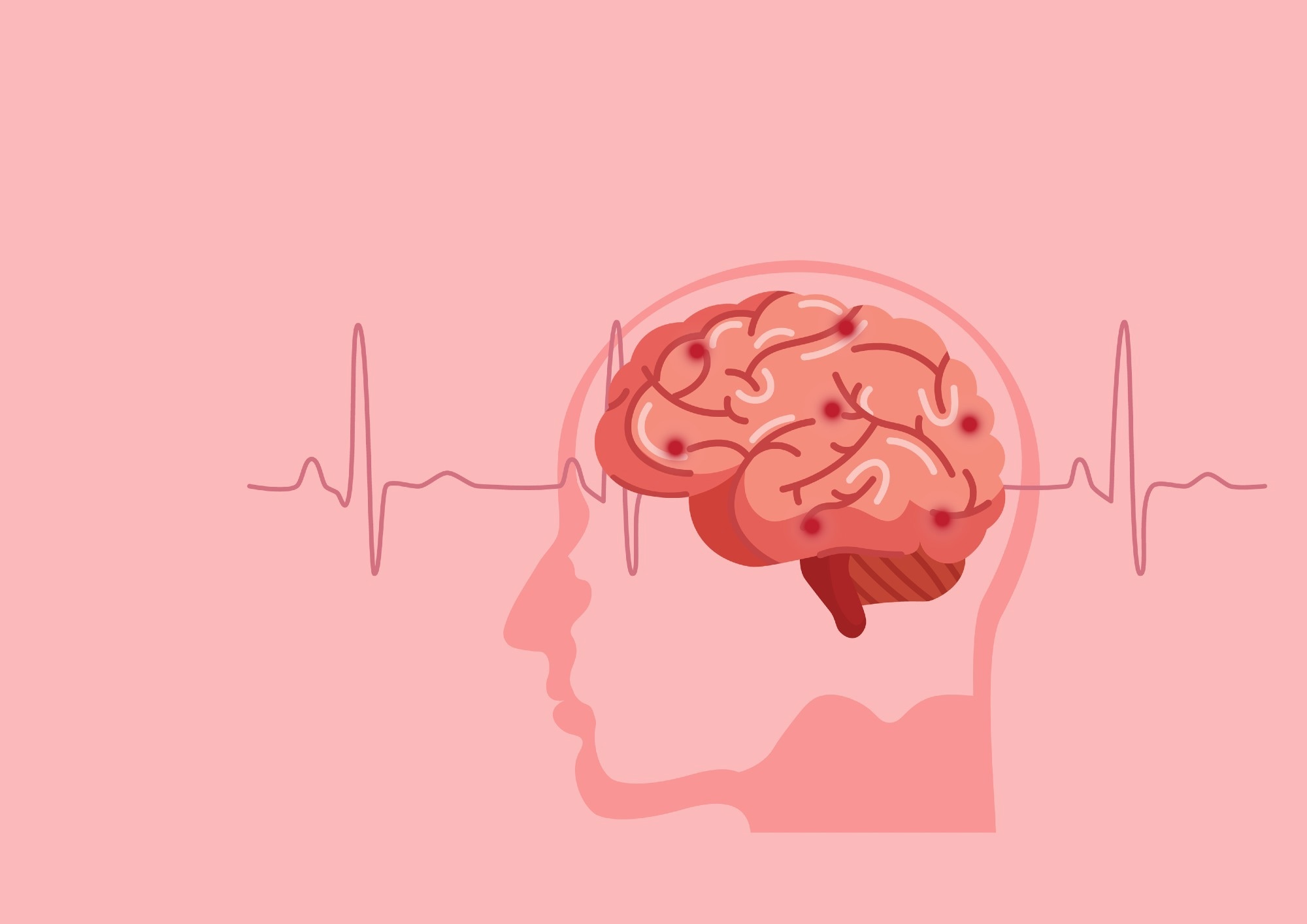 Study: Surge of neurophysiological coupling and connectivity of gamma oscillations in the dying human brain. Image Credit: Piyaphat_Detbun/Shutterstock.com