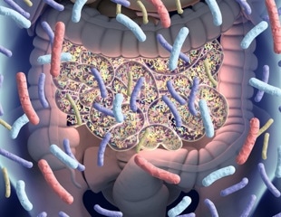 Parkinson's disease-like gut dysbiosis detected in early stages of the disease
