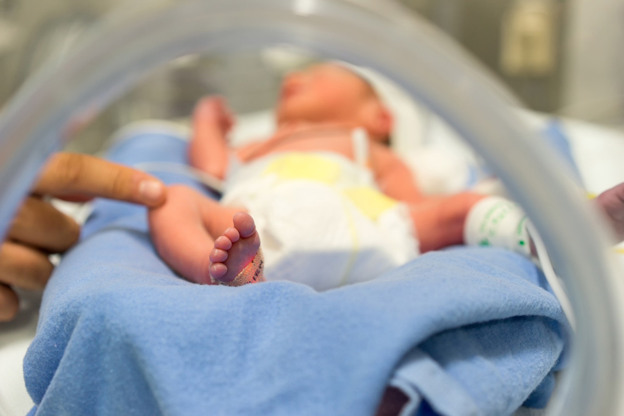 Study: Interplay of gestational parent exposure to ambient air pollution and diet characteristics on preterm birth. Image Credit: Kursad Sezgin / Shutterstock.com