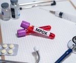 Understanding the adverse events profile of MVA-BN vaccine for Mpox