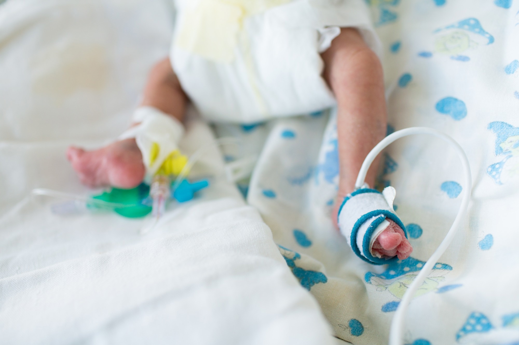 Study: Neonatal mortality risk for vulnerable newborn types in 15 countries using 125.5 million nationwide birth outcome records, 2000–2020. Image Credit: Kristina Bessolova / Shutterstock.com