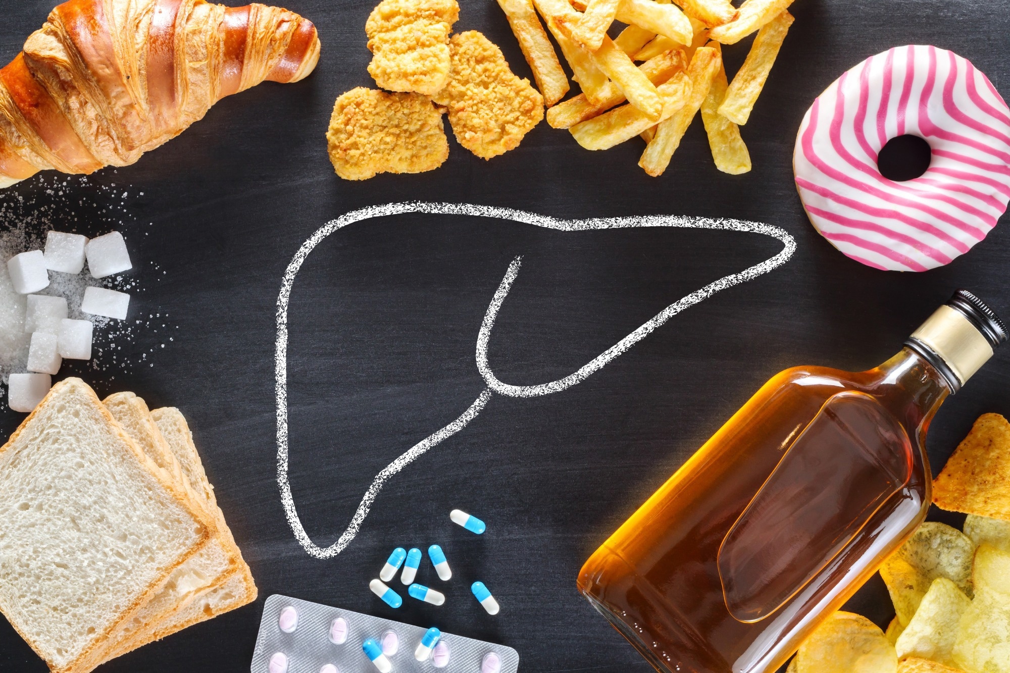 Study: Ultra-Processed Food Intake Is Associated with Non-Alcoholic Fatty Liver Disease in Adults: A Systematic Review and Meta-Analysis. Image Credit: Evan Lorne/Shutterstock.com