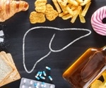 Consuming ultra-processed foods is associated with an increased risk of developing non-alcoholic fatty liver disease