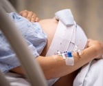 Does birth setting impact birth outcome?